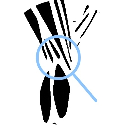 knee illustration round